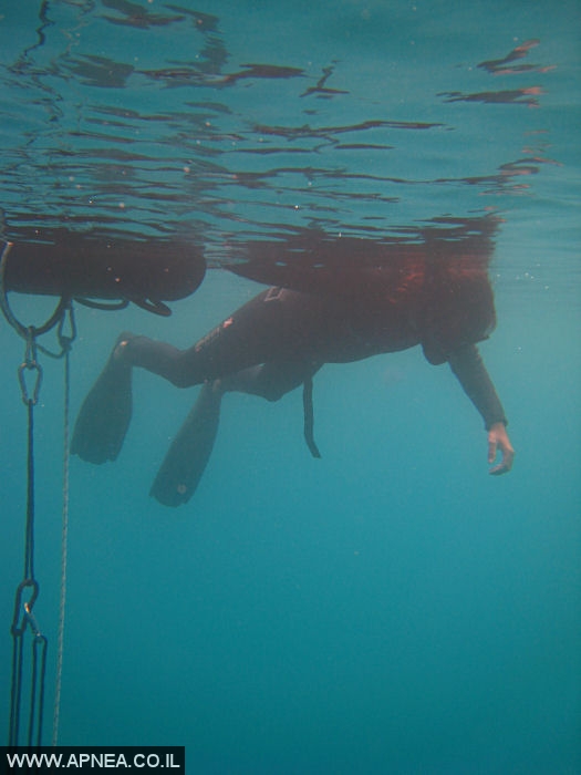    - APNEA -   - 003