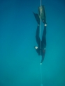    - APNEA -   