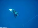             APNEA    