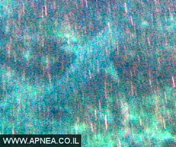  -  2008 - 001