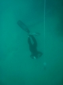    - APNEA -  