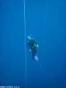            APNEA    